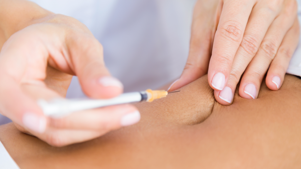Liposuzione completa Roma