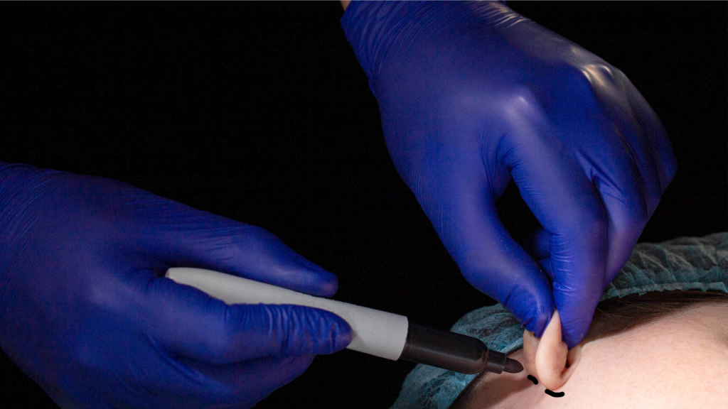 Prezzo Otoplastica in Milano