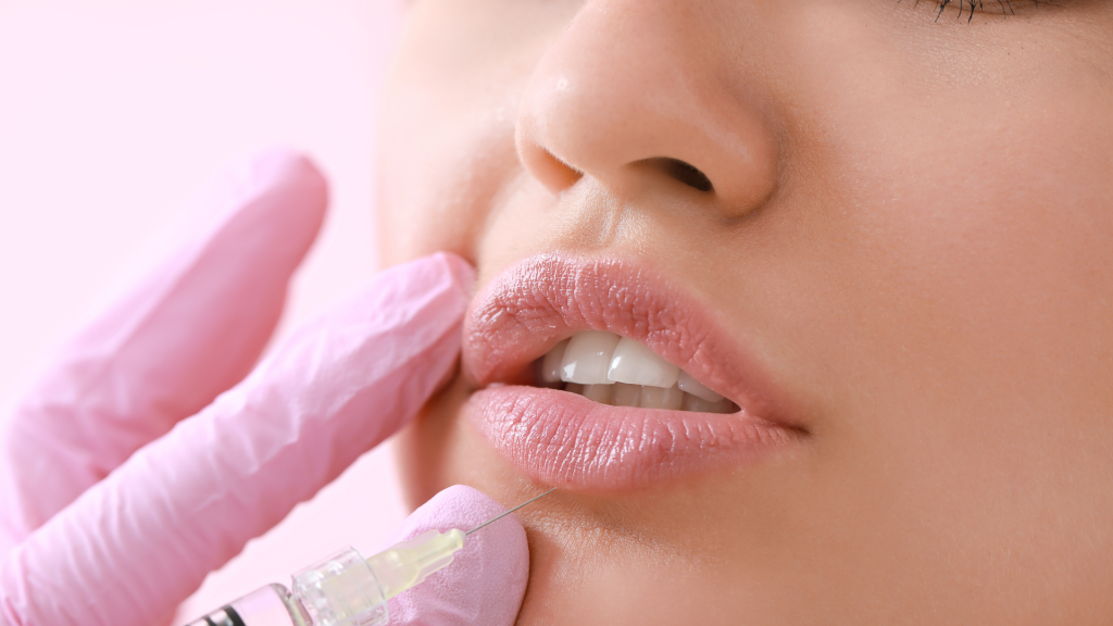 Intervento Filler Labbra a Milano